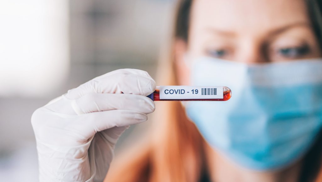 Ενδοκρινολογική Εταιρεία Η COVID-19 αποδιοργανώνει το ορμονικό σύστημα