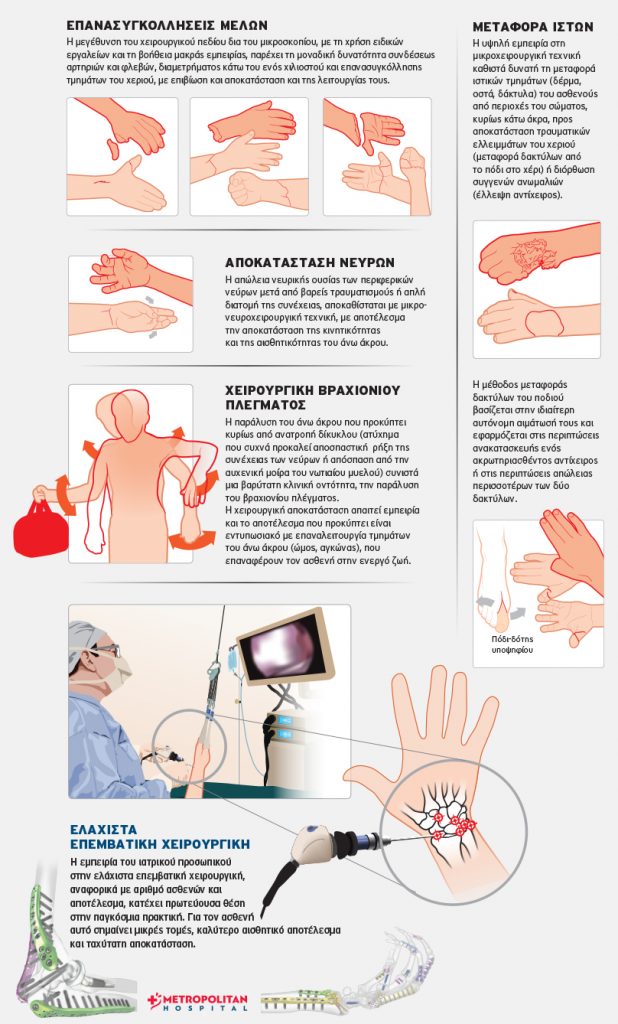 Οι πιο σύγχρονες θεραπείες για τις παθήσεις των χεριών