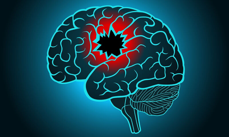 Υψηλότερος ο κίνδυνος αγγειακού εγκεφαλικού επεισοδίου αμέσως μετά από COVID-19