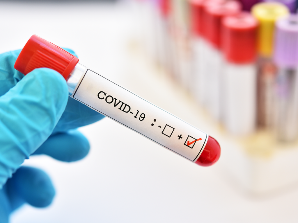 ΝΕΑ ΜΕΛΕΤΗ - ΓΕΡΑΣΙΜΟΣ ΣΙΑΣΟΣ: Η επίδραση της νόσου COVID-19 στα αγγεία είναι ανάλογη της βαρύτητας της νόσου