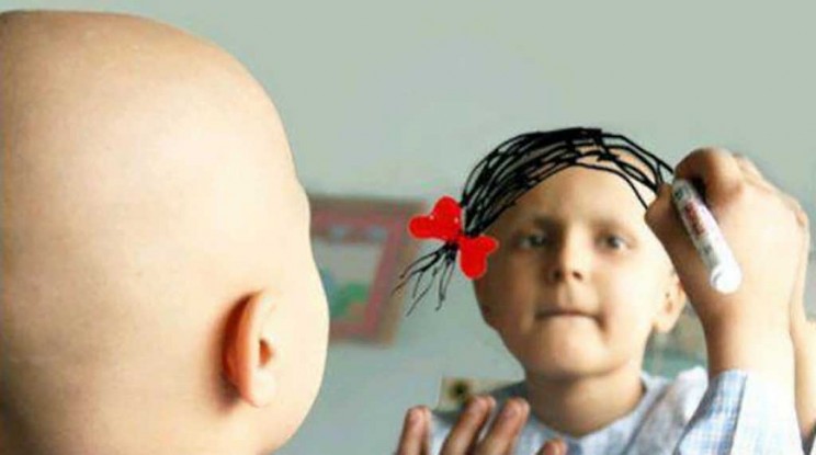 Καρκίνος Παιδικής Ηλικίας: Η καλύτερη επιβίωση είναι εφικτή