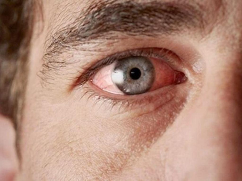 Ένα ολοκληρωμένο πρόγραμμα οφθαλμικής πρόληψης από τον Όμιλο Sanoptis. Εκκίνηση με την Παγκόσμια Εβδομάδα Γλαυκώματος (10 - 16 Μαρ 2024).
